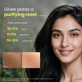 Fresh Neem Pimple Control Face Wash 150ml