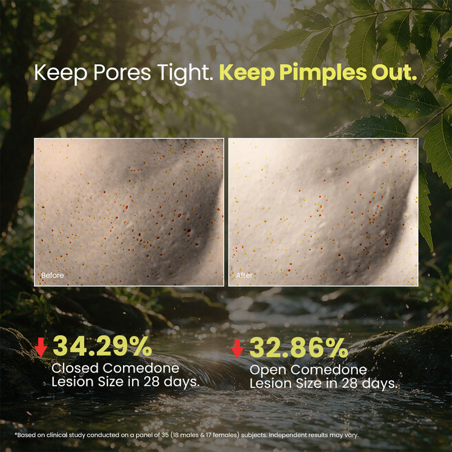 Fresh Neem Pimple Control Face Wash 150ml