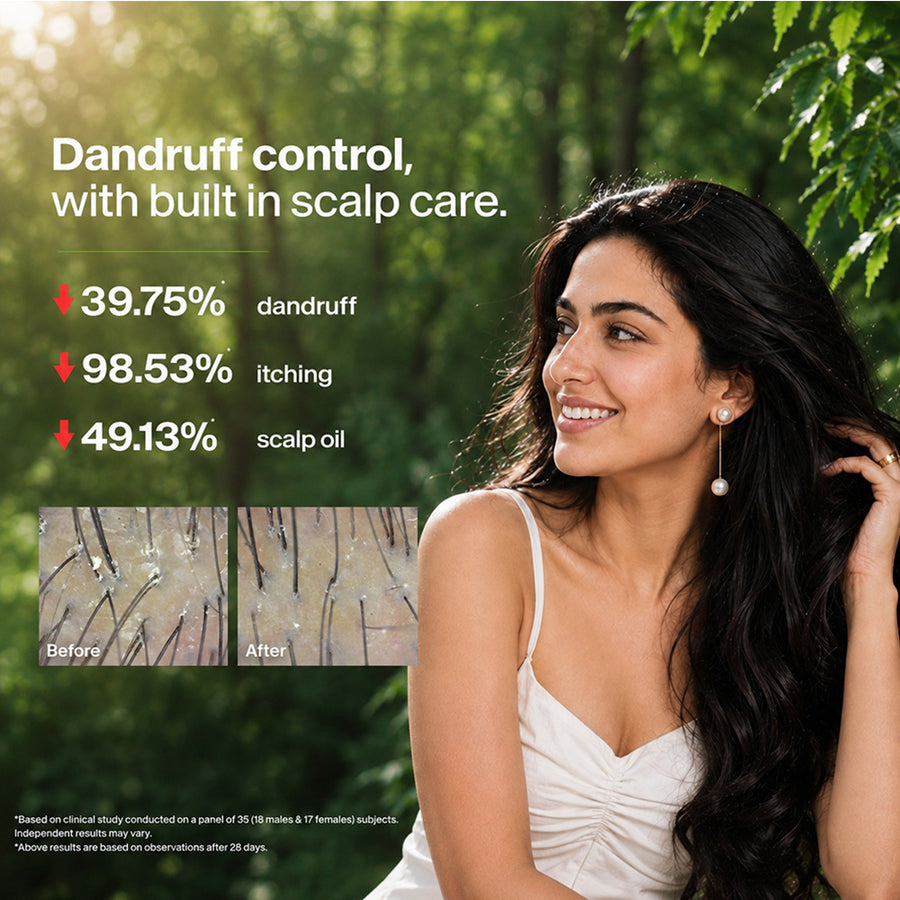 FRESH NEEM Anti Dandruff Shampoo & Conditioner pack of 2 (180ml)