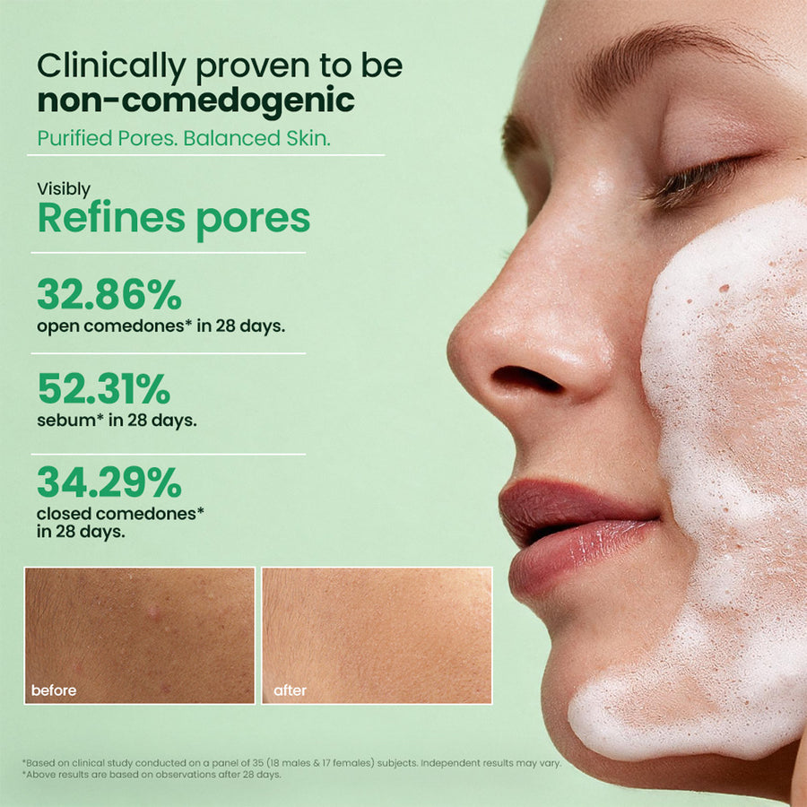 Fresh Neem Pimple Control Face Wash 150ml